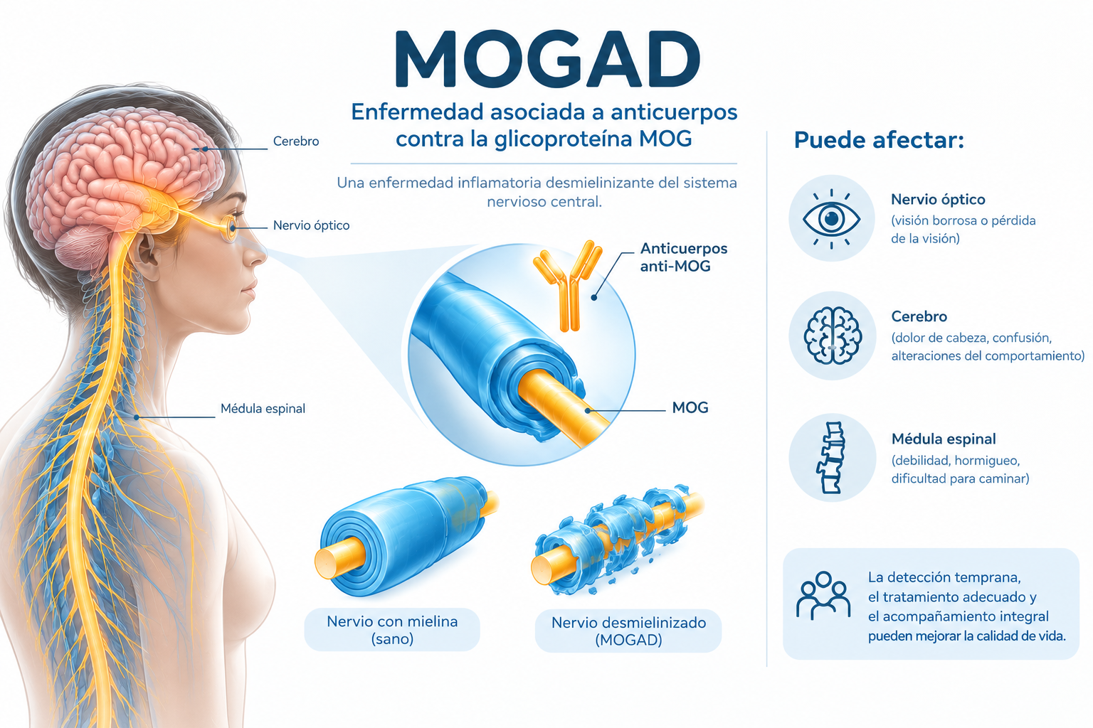 MOGAD